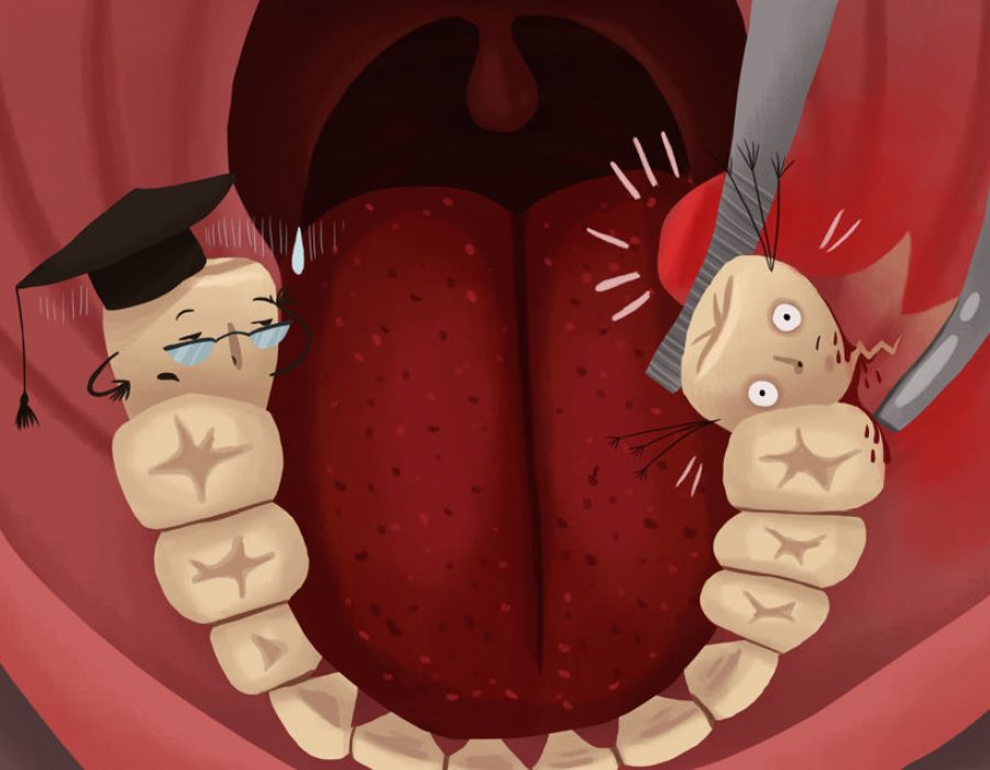 Localized periodontal disease